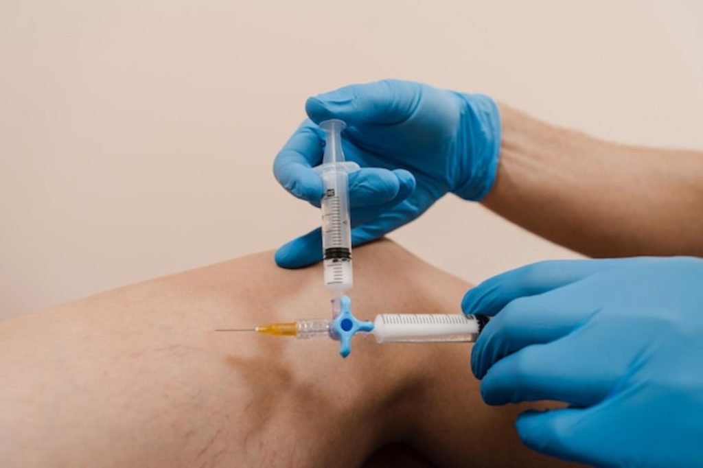 epidural injections
