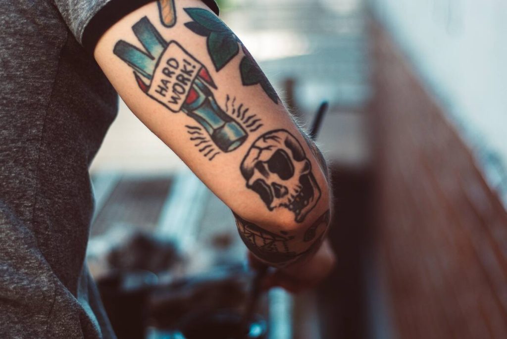 cheap Laser tattoo removal